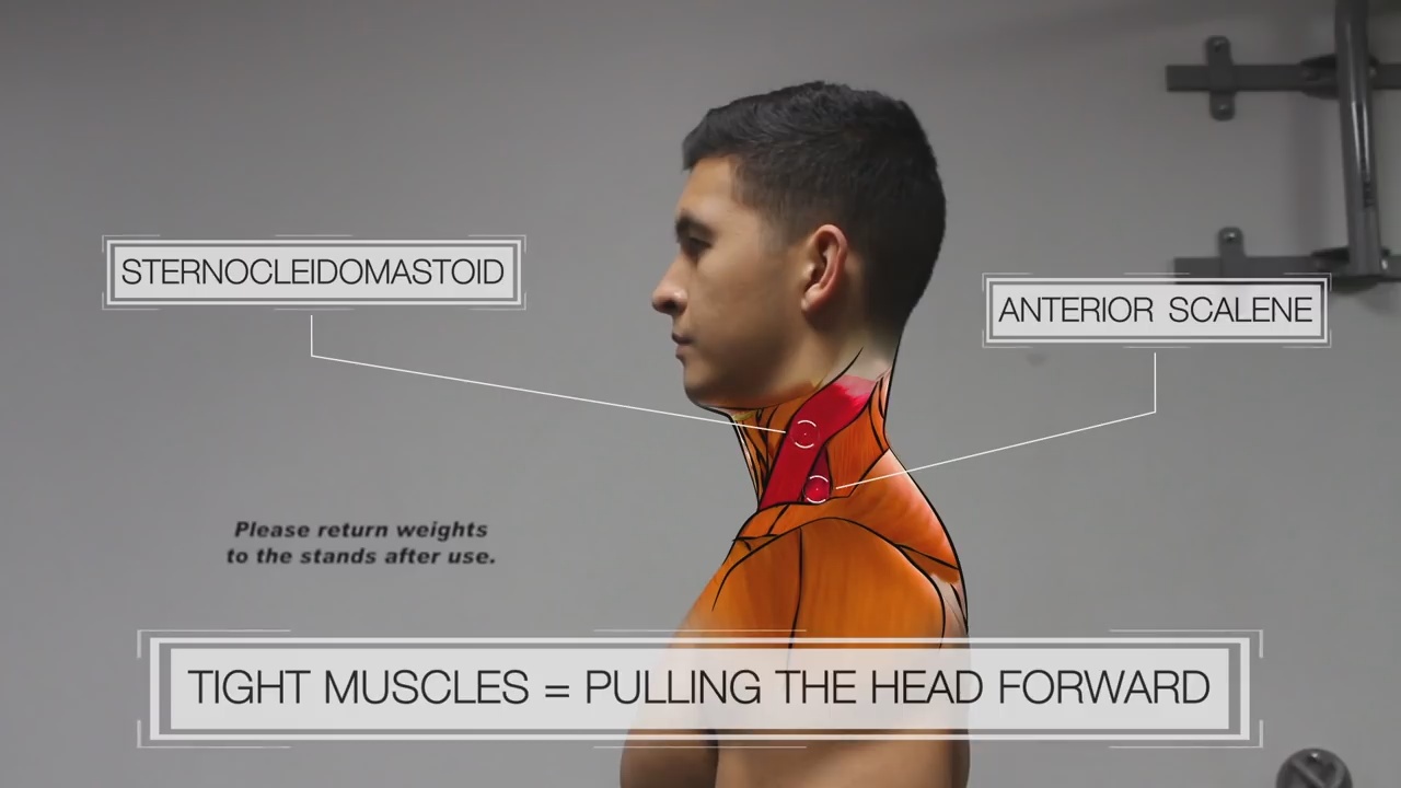 How Long Does It Take To Correct Forward Head Posture