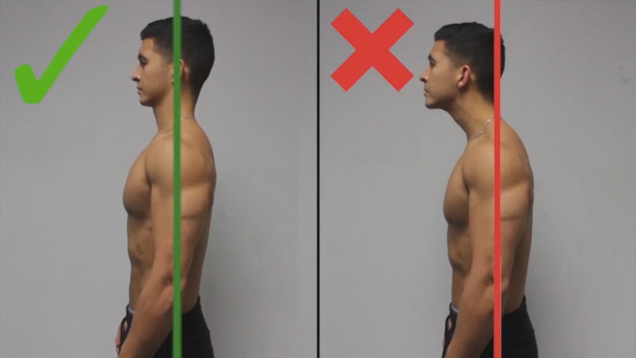 How Long Does It Take To Correct Forward Head Posture