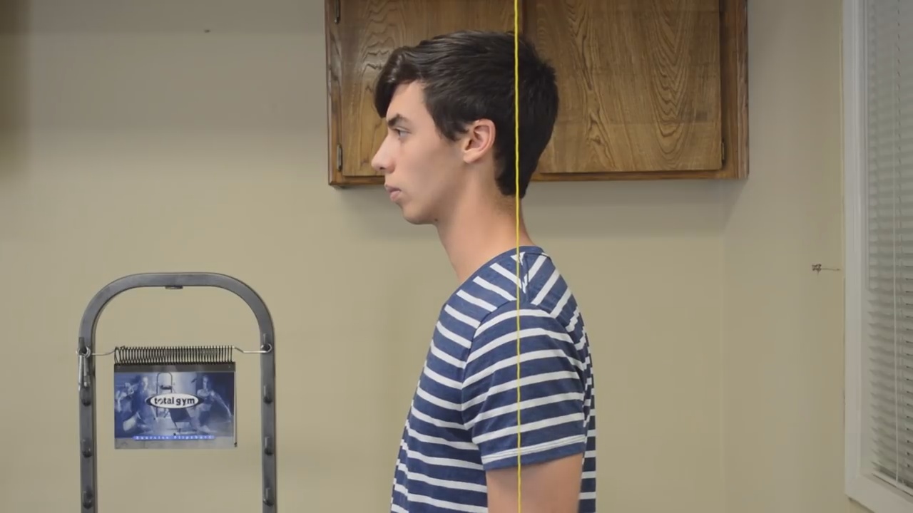 How Long Does It Take To Correct Forward Head Posture