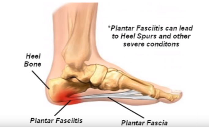 best boots for plantar fasciitis